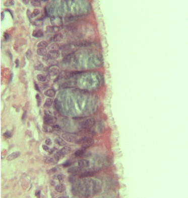 File:Psuedostratified epithelium animated.gif