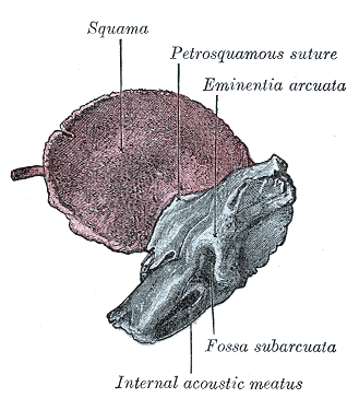 File:Gray144.png