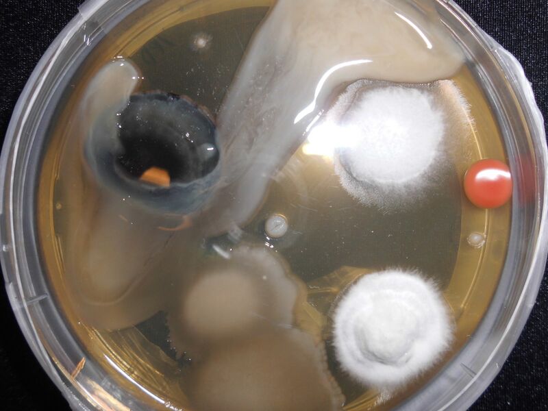 File:Contamination on agar plate.jpg