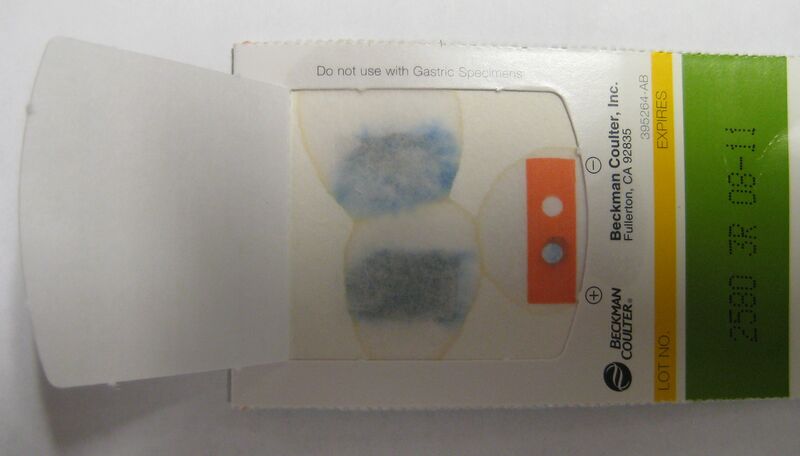 File:Positive fecal occult blood test.jpg