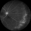 Thumbnail for version as of 22:36, 8 June 2026