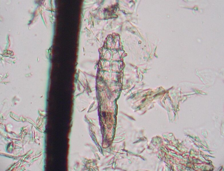 File:Demodex mite 1.JPG