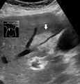 Thumbnail for version as of 03:41, 2 June 2026