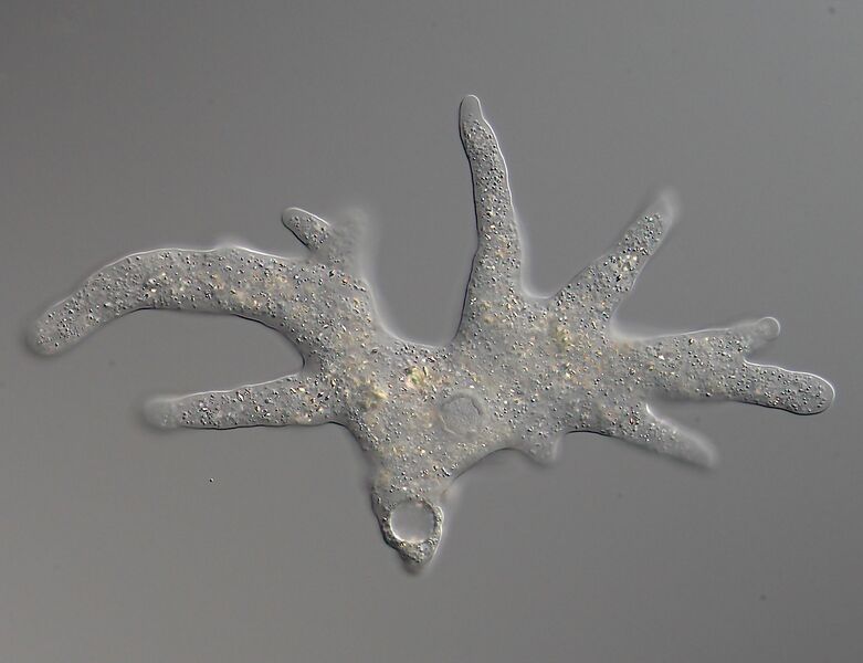 File:Amoeba proteus with many pseudopodia.jpg