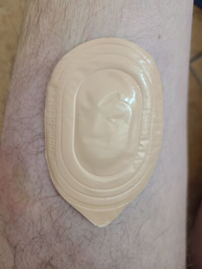 File:Androderm testosterone skin patch.jpg