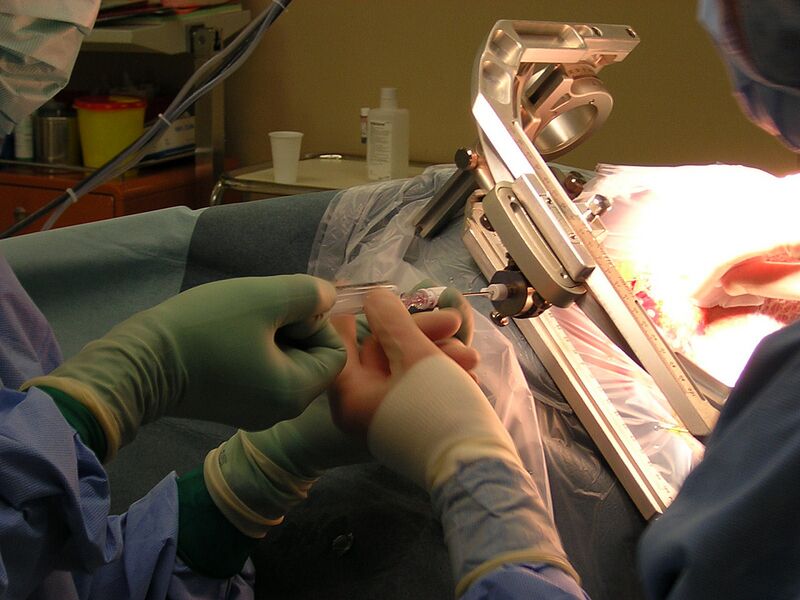 File:Brain biopsy under stereotaxy.jpg