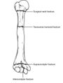 Thumbnail for version as of 02:11, 7 June 2026