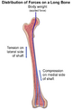 Femur Distribution of Forces