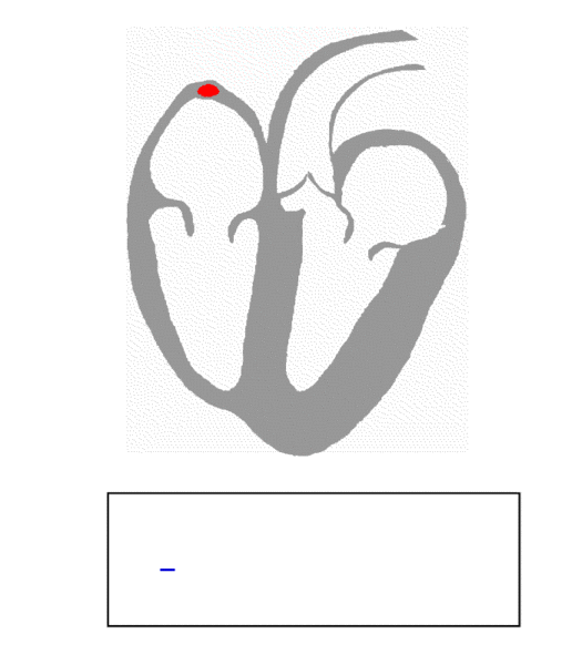 File:ECG Principle fast.gif