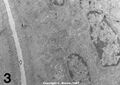 Intestinal villus