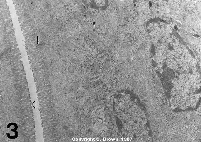 File:Nudemousejejunum EM.jpg