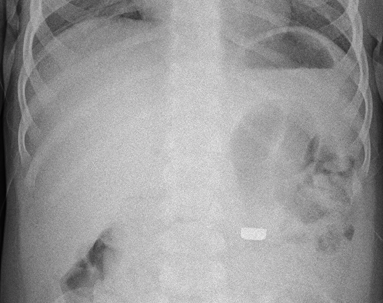 File:9mmbatteryintestines.png