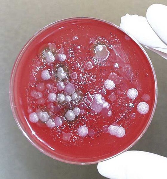 File:1993 Kameido site fluid petri.jpg