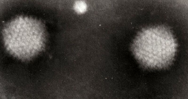 File:Adenovirus 4.jpg