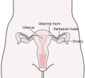 Image showing the position of the Fallopian tubes between the ovaries and the uterus.