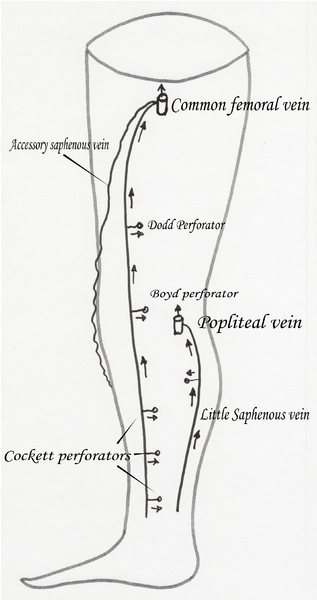 File:Accessory saphenous vein2.png