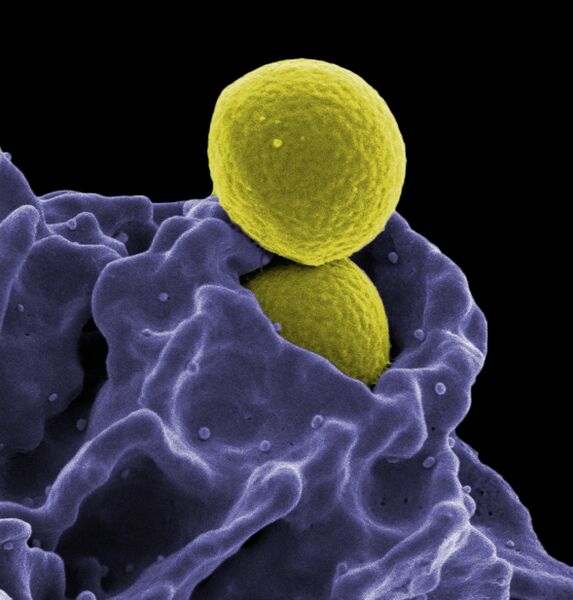 File:MRSA, Ingestion by Neutrophil.jpg