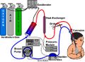 ECMO schema