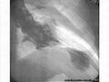 Thumbnail for version as of 22:25, 8 June 2026