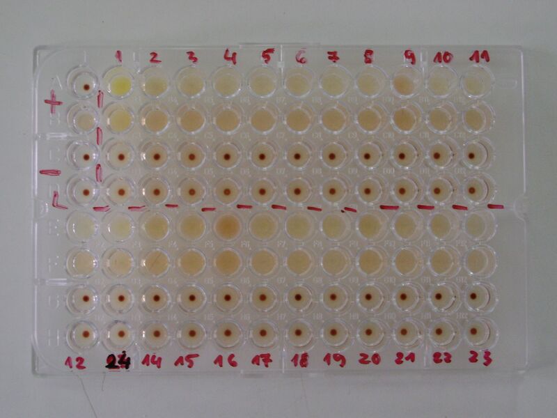 File:TPHA test on microplate wells.jpg