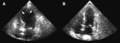 Thumbnail for version as of 22:26, 8 June 2026