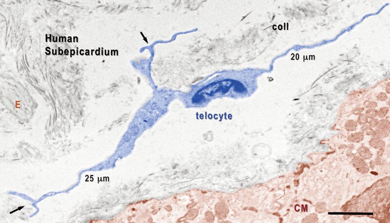 File:Telocytes - Fig 2.jpg