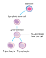 Diagram showing the cell that ALL starts in