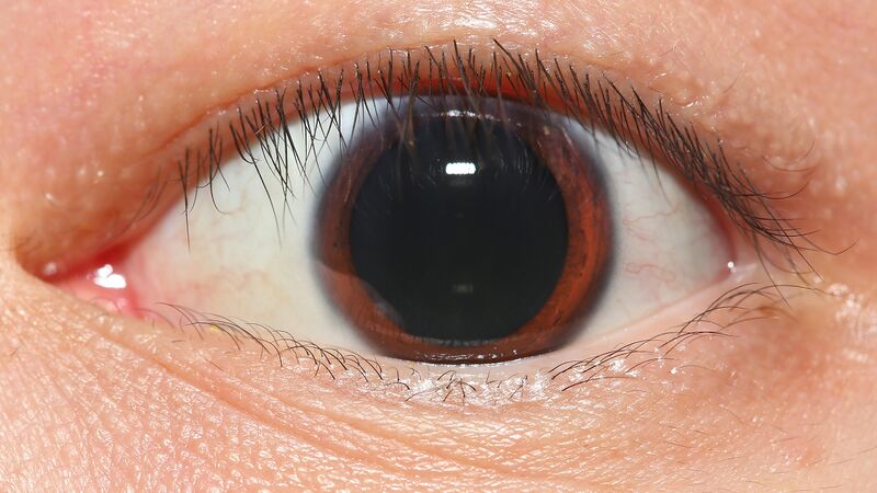 File:Human eye in dim light.jpg
