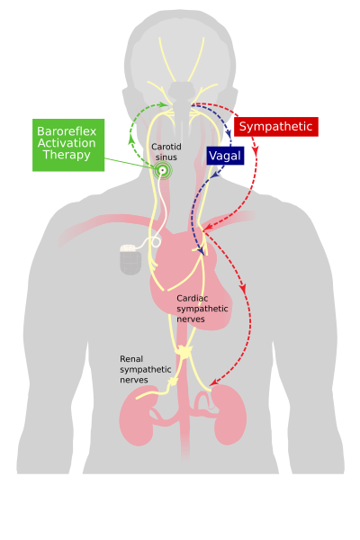 File:Baroreflex activation.svg