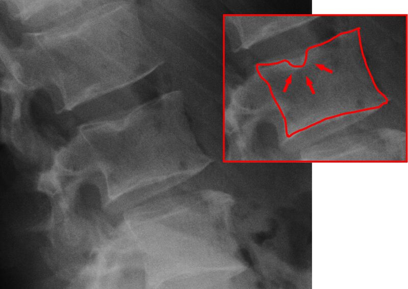 File:Roe-schmorl.jpg