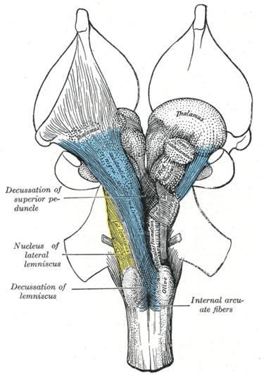 File:Gray690.png