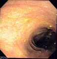Thumbnail for version as of 22:28, 8 June 2026