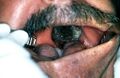 Thumbnail for version as of 22:35, 8 June 2026