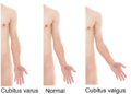Thumbnail for version as of 03:21, 5 June 2026