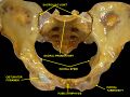 Ischial spine