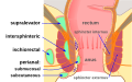 Thumbnail for version as of 22:13, 18 May 2026
