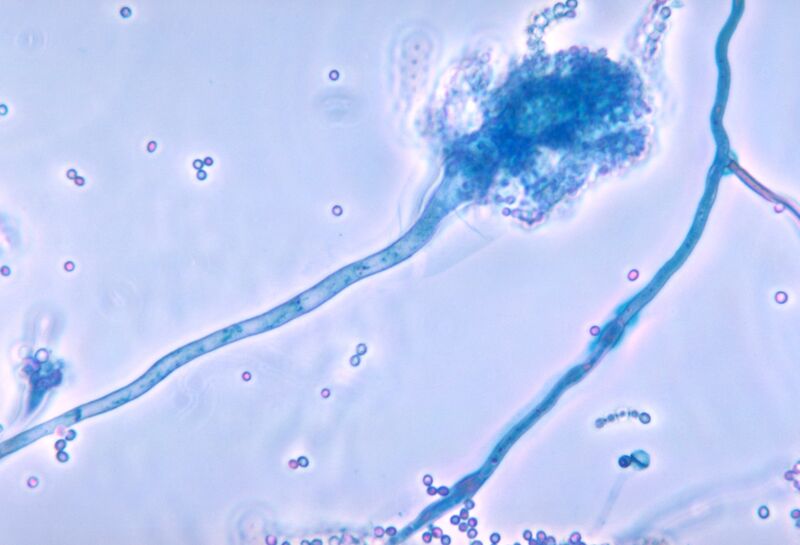 File:Aspergillus fumigatus 01.jpg