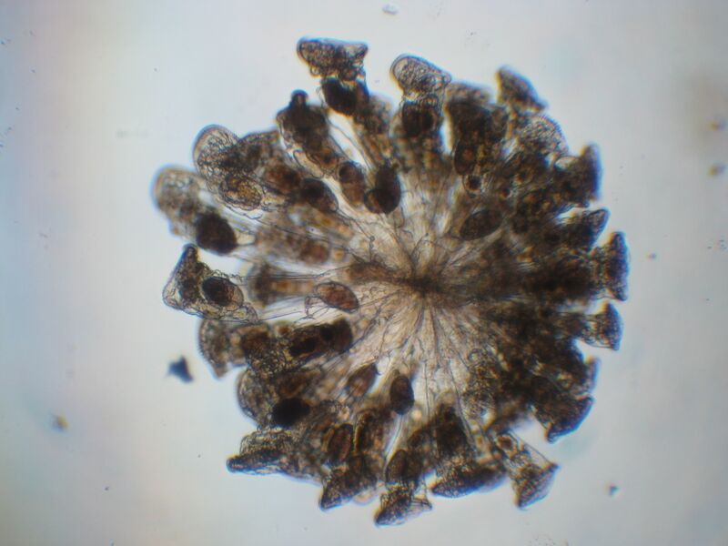 File:20100708 colonial rotifer Conochilius.JPG