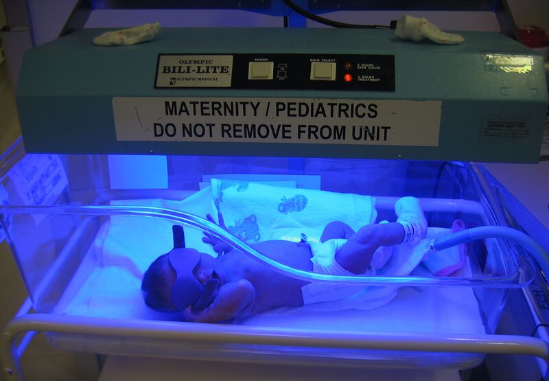 File:Bili light with newborn.jpg