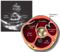 Thumbnail for version as of 03:23, 5 June 2026
