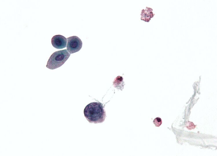 File:Polyomavirus.jpg