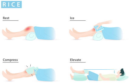 File:RICE medicine.svg