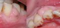Thumbnail for version as of 13:37, 8 June 2026