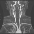 Magnetic resonance imaging
