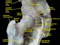 Greater trochanter