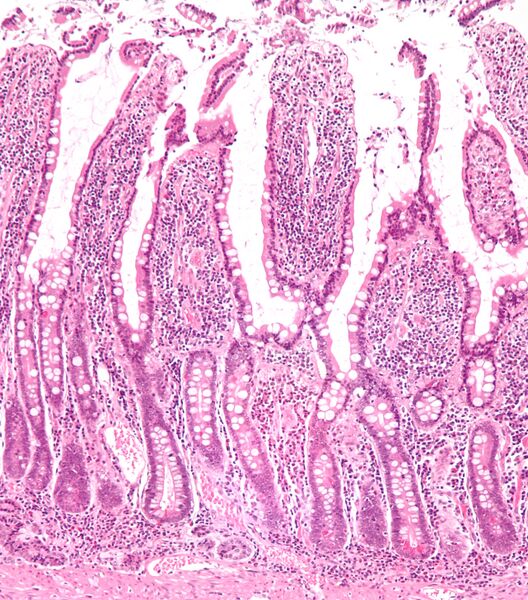 File:Small intestine low mag.jpg
