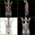 Thumbnail for version as of 22:31, 8 June 2026