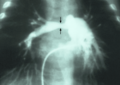 Thumbnail for version as of 03:23, 5 June 2026