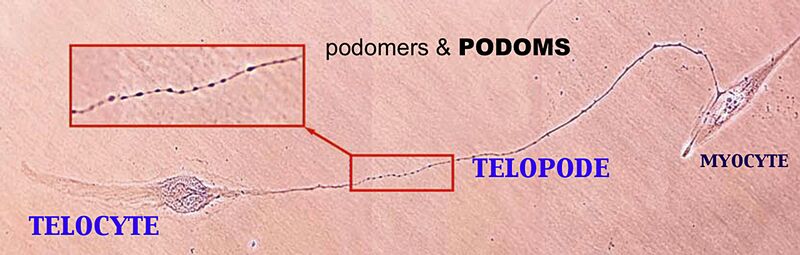 File:Telocytes - Fig 1.jpg