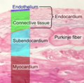 Histology of endocardium and subendocardium